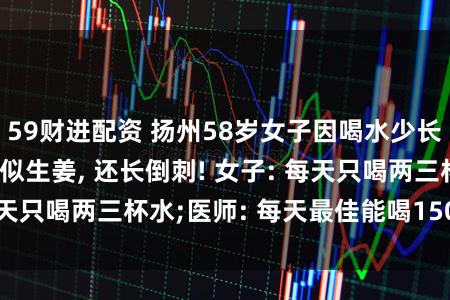 59财进配资 扬州58岁女子因喝水少长巨型肾结石, 形似生姜, 还长倒刺! 女子: 每天只喝两三杯水;医师: 每天最佳能喝1500毫升水